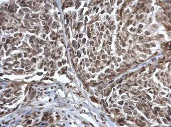 Anti-Coilin antibody used in IHC (Paraffin sections) (IHC-P). GTX112570