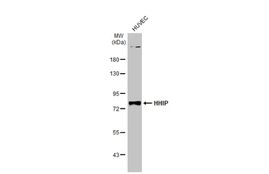 Anti-HHIP antibody [N3C2], Internal used in Western Blot (WB). GTX112584