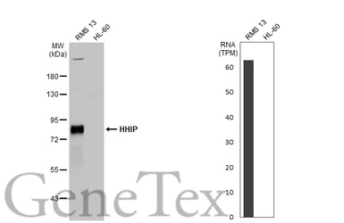 Anti-HHIP antibody [N3C2], Internal used in Western Blot (WB). GTX112584