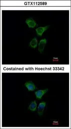 Anti-ERO1L antibody used in Immunocytochemistry/ Immunofluorescence (ICC/IF). GTX112589