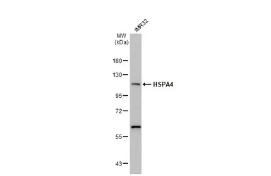 Anti-HSPA4 antibody [N3C2], Internal used in Western Blot (WB). GTX112607