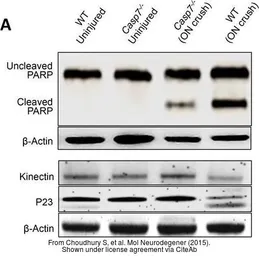 Anti-p23 antibody [N1C3-2] used in Western Blot (WB). GTX112655