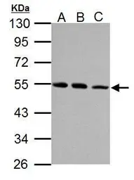 Anti-beta Tubulin antibody used in Western Blot (WB). GTX112658