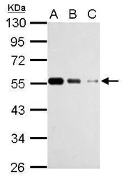 Anti-beta Tubulin antibody used in Western Blot (WB). GTX112658