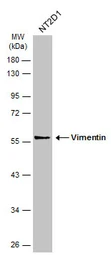 Anti-Vimentin antibody used in Western Blot (WB). GTX112661