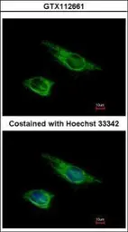Anti-Vimentin antibody used in Immunocytochemistry/ Immunofluorescence (ICC/IF). GTX112661