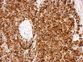 Anti-Vimentin antibody used in IHC (Paraffin sections) (IHC-P). GTX112661