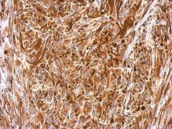 Anti-Vimentin antibody used in IHC (Paraffin sections) (IHC-P). GTX112661