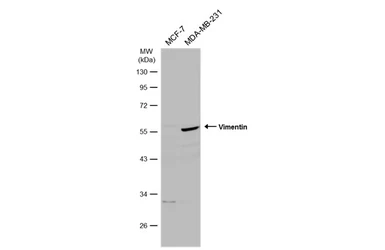 Anti-Vimentin antibody used in Western Blot (WB). GTX112661
