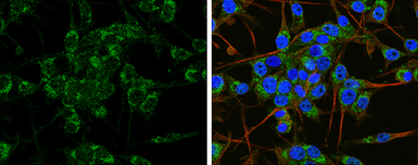 Anti-APP antibody used in Immunocytochemistry/ Immunofluorescence (ICC/IF). GTX112677