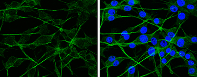 Anti-APP antibody used in Immunocytochemistry/ Immunofluorescence (ICC/IF). GTX112677