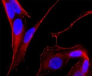 Anti-MAP2 antibody [AP-20] used in Immunocytochemistry/ Immunofluorescence (ICC/IF). GTX11268