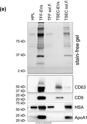 Anti-Apolipoprotein A1 antibody used in Western Blot (WB). GTX112692