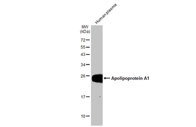 Anti-Apolipoprotein A1 antibody used in Western Blot (WB). GTX112692