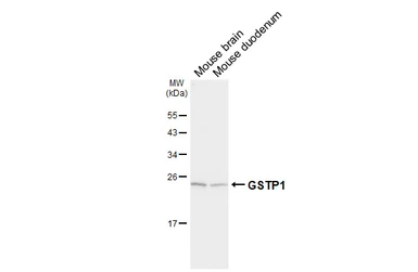 Anti-GSTP1 antibody used in Western Blot (WB). GTX112695