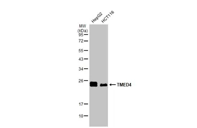 Anti-TMED4 antibody [N1C3] used in Western Blot (WB). GTX112712