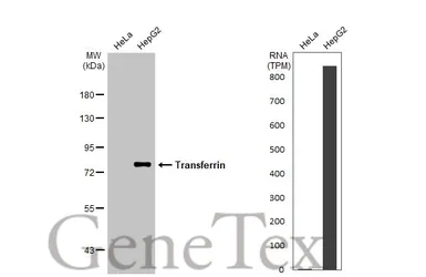 Anti-Transferrin antibody [N3C2], Internal used in Western Blot (WB). GTX112729