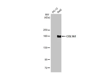 Anti-COL1A1 antibody [N1N2], N-term used in Western Blot (WB). GTX112731