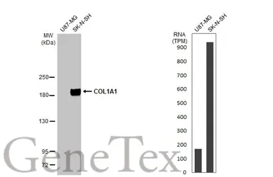 Anti-COL1A1 antibody [N1N2], N-term used in Western Blot (WB). GTX112731