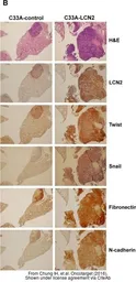 Anti-N-Cadherin antibody [N1N3] used in IHC (Paraffin sections) (IHC-P). GTX112734