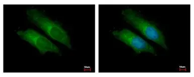 Anti-BCL10 antibody used in Immunocytochemistry/ Immunofluorescence (ICC/IF). GTX112744
