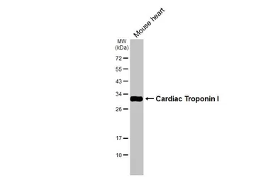 Anti-Cardiac Troponin I antibody [N1C3-2] used in Western Blot (WB). GTX112770