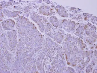 Anti-UCP1 antibody used in IHC (Paraffin sections) (IHC-P). GTX112784