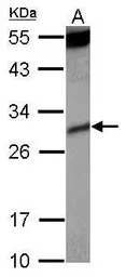 Anti-KIR2DS4 antibody [N1C3-2] used in Western Blot (WB). GTX112787