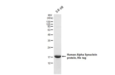 Human Alpha Synuclein protein, His tag. GTX112799-pro