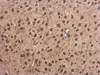 Anti-alpha Synuclein antibody used in IHC (Paraffin sections) (IHC-P). GTX112799