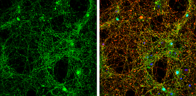 Anti-alpha Synuclein antibody used in Immunocytochemistry/ Immunofluorescence (ICC/IF). GTX112799