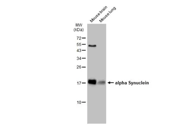 Anti-alpha Synuclein antibody used in Western Blot (WB). GTX112799