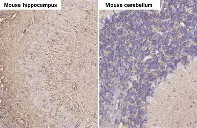Anti-alpha Synuclein antibody used in IHC (Paraffin sections) (IHC-P). GTX112799