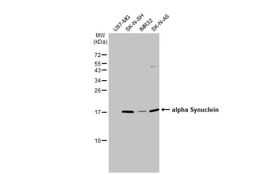 Anti-alpha Synuclein antibody used in Western Blot (WB). GTX112799