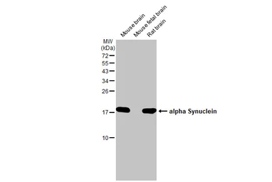 Anti-alpha Synuclein antibody used in Western Blot (WB). GTX112799