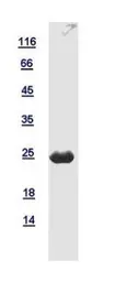 Human RGS5 protein, His tag. GTX112807-pro