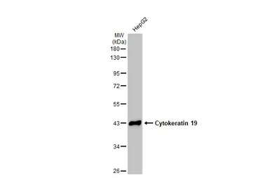 Anti-Cytokeratin 19 antibody [N1C1] used in Western Blot (WB). GTX112826