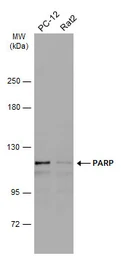 Anti-PARP antibody [N1N2], N-term used in Western Blot (WB). GTX112839