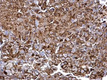 Anti-CD44 antibody [N1N2], N-term used in IHC (Paraffin sections) (IHC-P). GTX112893