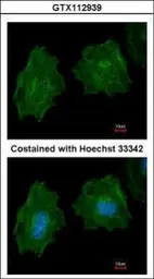 Anti-Filamin A antibody [C2], C-term used in Immunocytochemistry/ Immunofluorescence (ICC/IF). GTX112939