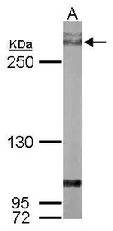 Anti-Filamin A antibody [C2], C-term used in Western Blot (WB). GTX112939