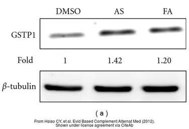 Anti-GSTP1 antibody used in Western Blot (WB). GTX112953