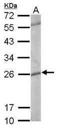 Anti-GSTP1 antibody used in Western Blot (WB). GTX112953
