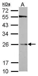 Anti-GSTP1 antibody used in Western Blot (WB). GTX112953