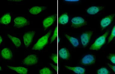 Anti-GSTP1 antibody used in Immunocytochemistry/ Immunofluorescence (ICC/IF). GTX112953