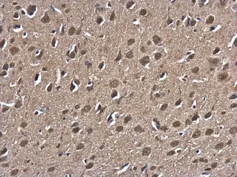 Anti-Hsp70 antibody used in IHC (Paraffin sections) (IHC-P). GTX112963