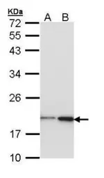Anti-nm23-H1 antibody [N1C3] used in Western Blot (WB). GTX112988