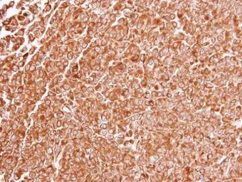 Anti-TLR3 antibody used in IHC (Paraffin sections) (IHC-P). GTX113022