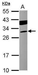 Anti-Cardiac Troponin I antibody [N1C3-3] used in Western Blot (WB). GTX113028