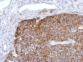 Anti-TRAF6 antibody [N2C2], Internal used in IHC (Paraffin sections) (IHC-P). GTX113029